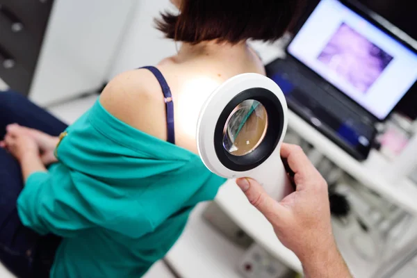 Dermatolog zkoumá molů pacientů s pomocí speciální volební lupy. — Stock fotografie
