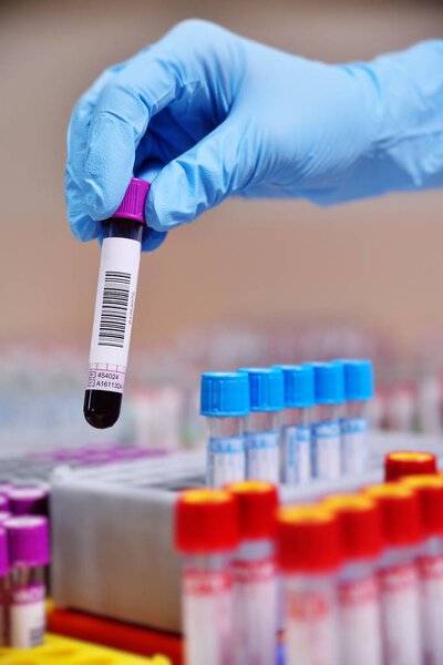 медицинские пробирки с анализами крови
