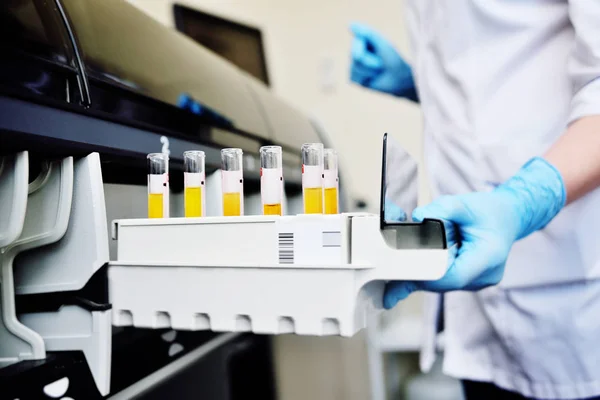 Вчений в лабораторії розміщує пробірки з кров'ю або сечею в контейнері теплоаналізатора — стокове фото