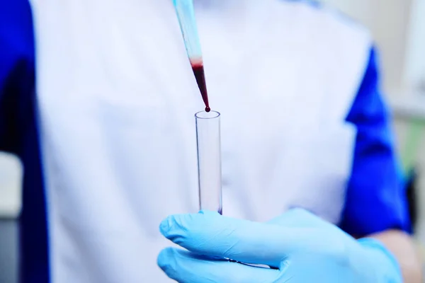 Медицинские пробирки с анализами крови — стоковое фото