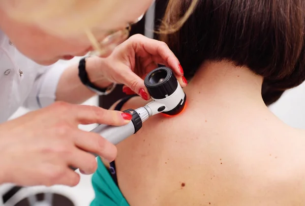 Diagnóstico de melanoma inspecionado. o médico examina a toupeira pacientes — Fotografia de Stock