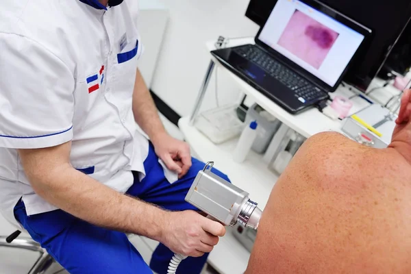 The dermatologist examines the moles or acne of the patient with a dermatoscope.