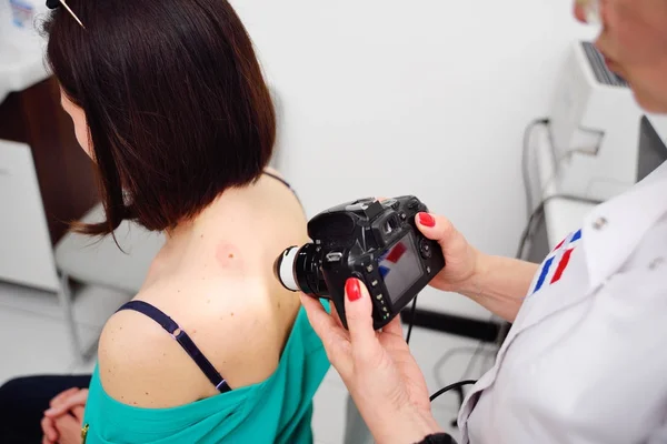 O dermatologista examina as toupeiras ou acne do paciente com um dermatoscópio — Fotografia de Stock