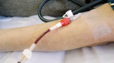 Plazma kan elemanları çıkarmadan kan üzerinden kaldırılması