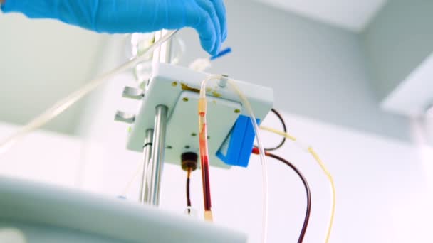 Eliminación del plasma de la sangre sin eliminar los elementos sanguíneos — Vídeo de stock