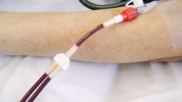 Borttagning av plasma från blodet utan att ta bort blod elementen — Stockvideo