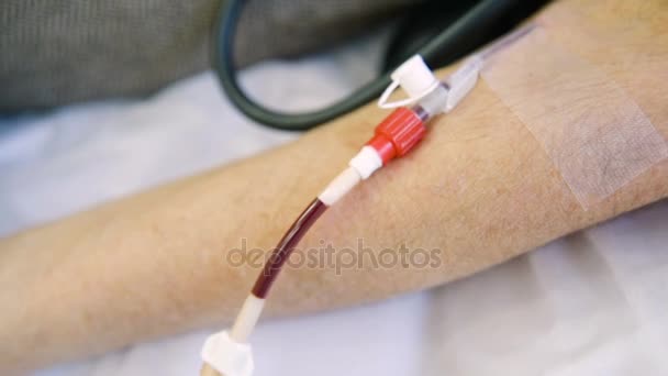 Plazma kan elemanları çıkarmadan kan üzerinden kaldırılması — Stok video