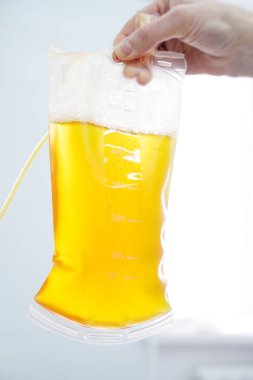 Plazma bir plastik torba