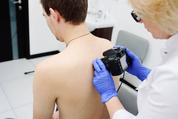 O doutor dermatologista examina nevos e nevos do paciente com um dermatoscópio — Fotografia de Stock