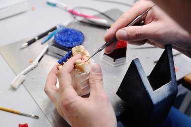ortodontist çene seramik bir baskı yapar