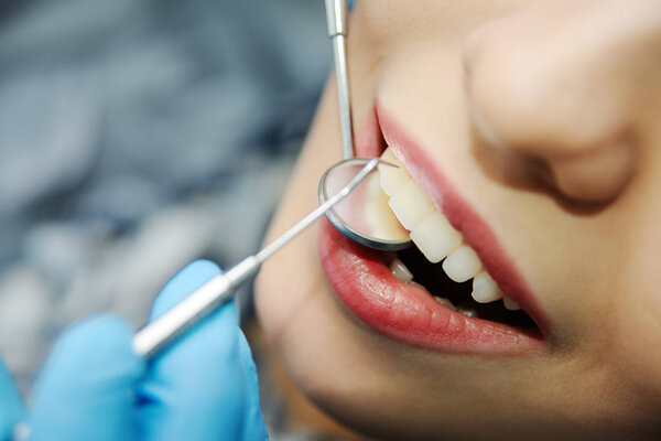 зубы красивой девушки крупным планом
.