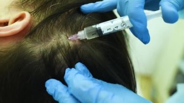 cosmetic surgery performs a procedure for hair regeneration by mesotherapy-injection of the patients plasma into the scalp.