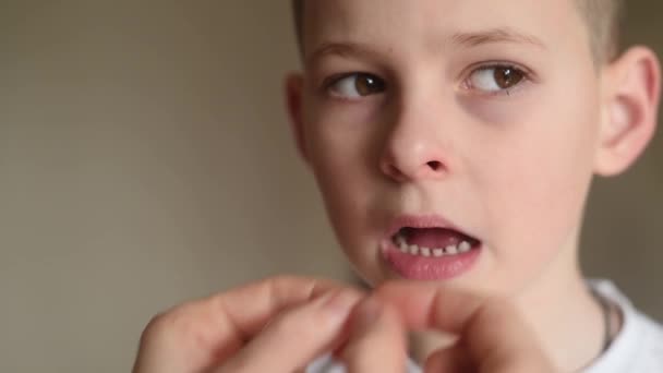 Mãe solta e tenta arrancar um dente de leite para um menino pequeno usando fio dental . — Vídeo de Stock
