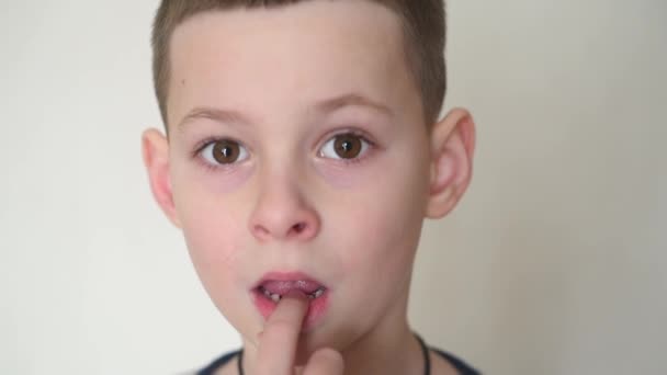 Small child boy loosens a baby tooth with his finger — Wideo stockowe