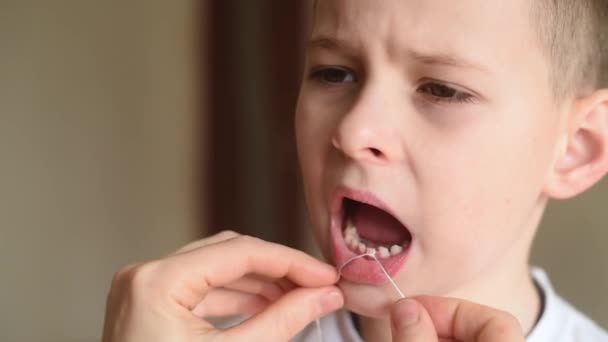 Mother loosens and tries to pull out a baby tooth to a small child boy using dental floss. — Stok video