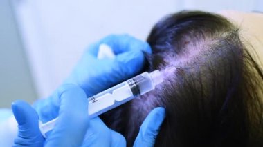 cosmetic surgery performs a procedure for hair regeneration by mesotherapy-injection of the patients plasma into the scalp.