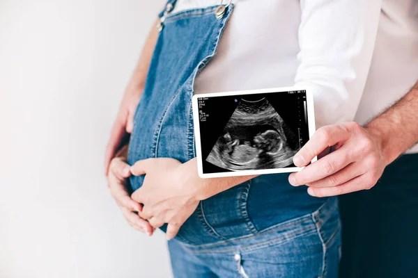 Genç adam ve kadın birlikte beyaz arka planda izole bir şekilde duruyorlar. Adamın elinde geleceklerinin ultrason fotoğrafı var. Kadın göbeğin üstünde el ele tutuşuyor. Yeni doğmuş bir bebek bekliyor.. — Stok fotoğraf