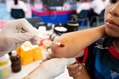Bangkok, Thailand - July 27, 2019 ; Sport Event named Heroes TaeKwonDo International Championship 2019. Nurse EMS first aid injuries player accident at arms and pain at Assumption University