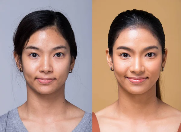 亚洲女人在申请后化妆的发型 没有皱纹 脸上有粉刺 皮肤光滑 工作室照明灰黄色背景 用于美学治疗 — 图库照片