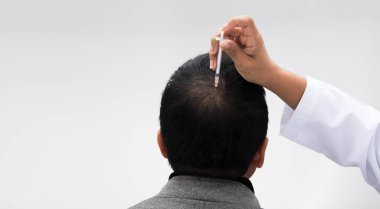 Estetik Doktoru, çalışan yaşlı bir kadında düşmeyi önlemek için şırınga, kısa saç terapi kliniği, saç dökülme bölgesine serum vitaminleri enjekte ediyor.