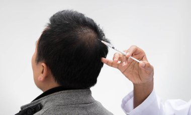 Estetik Doktoru, çalışan yaşlı bir kadında düşmeyi önlemek için şırınga, kısa saç terapi kliniği, saç dökülme bölgesine serum vitaminleri enjekte ediyor.