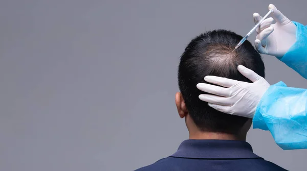 Estetik Doktoru, çalışan yaşlı bir kadında düşmeyi önlemek için şırınga, kısa saç terapi kliniği, saç dökülme bölgesine serum vitaminleri enjekte ediyor.