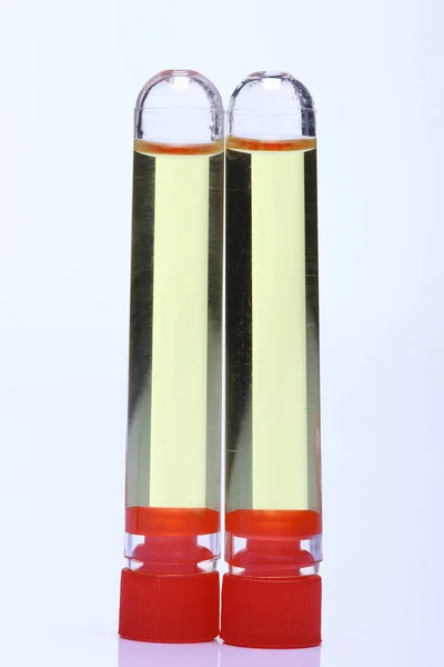 Sarı Sıvı Iki Cam Tüp Kırmızı Kapaklı Grup Laboratuvar Test — Stok fotoğraf