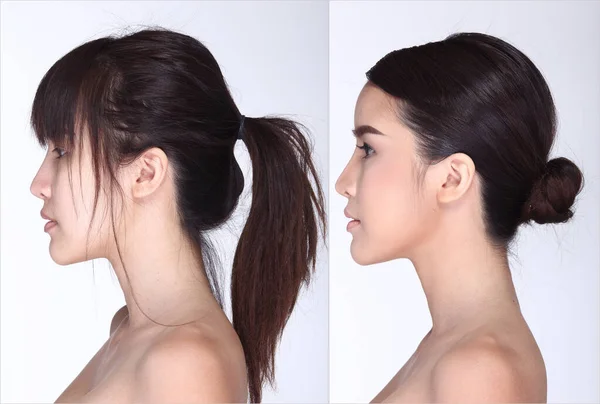 アジアの女性は髪のスタイルを構成する前に レタッチなしにきびのある新鮮な顔肌のモル スタジオ照明白地 — ストック写真