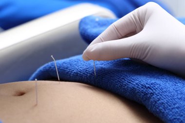 Beauty Spa 'daki profesyonel akupunktur tedavisini kapatın. Vücut, mide, bacak, el, yüz, yanak, alın uzmanlığı olan Çin İğne Enstitüsü' nden güzellik uzmanları, yaşlanmayı önleme konsepti.