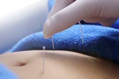 Beauty Spa 'daki profesyonel akupunktur tedavisini kapatın. Vücut, mide, bacak, el, yüz, yanak, alın uzmanlığı olan Çin İğne Enstitüsü' nden güzellik uzmanları, yaşlanmayı önleme konsepti.