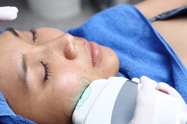 Asyalı kadına, cildini pürüzsüz kılmak ve sivilceleri tedavi etmek için hastane kliniğindeki soğuk algınlığı aleti ile tedavi etmek için sabırlı davranılmalıdır.