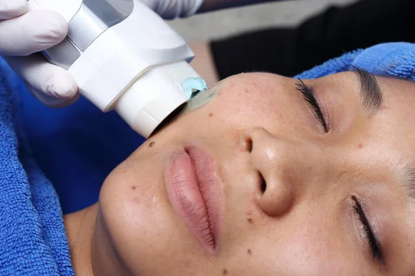 Лікування Азіатської Жінки Пацієнта Щоб Зробити Шкіру Гладкою Яскравою Вилікувати — стокове фото