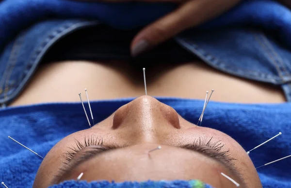 Close Hand Uitvoeren Medische Behandeling Van Professionele Acupunctuur Beauty Spa — Stockfoto