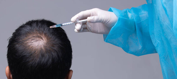 Aesthetics Doctor inject treatment serum vitamins to hair fall area on head by Syringe, Short Hair Loss control therapy clinic to prevent falling in working senior man woman, studio lighting isolated