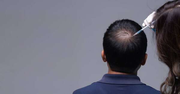 Aesthetics Doctor inject treatment serum vitamins to hair fall area on head by Syringe, Short Hair Loss control therapy clinic to prevent falling in working senior man woman, studio lighting isolated