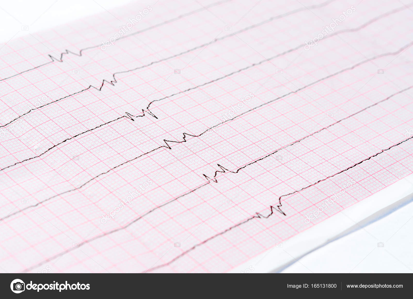 Ecg With Single Ventricular Complexes And Ventricular Asystole Dying Heart Stock Photo Image By C Olga355