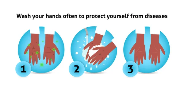 Πλύνετε τα χέρια infographic. Βρώμικα χέρια με βακτήρια που κρατούν σαπουνόφουσκες κάτω από νερό. Χέρι σε σαπουνόφουσκες. Vector εικονογράφηση επίπεδη σχεδίαση.Προσωπική υγιεινή. Απολύμανση, περιποίηση δέρματος. Αντιβακτηριδιακό — Διανυσματικό Αρχείο