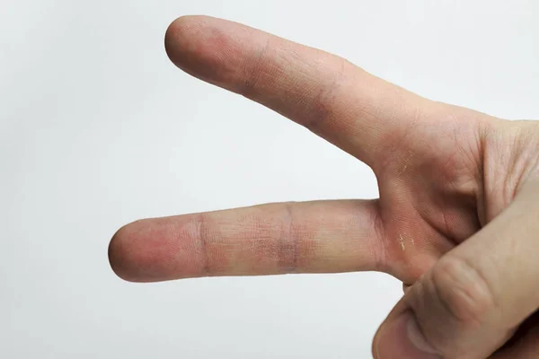 İki parmak beyaz değildir. — Stok fotoğraf