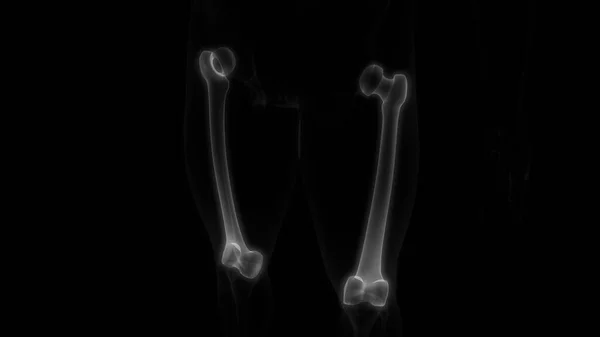 Femur Csontos Ízületek Emberi Csontváz Rendszer Anatómia Renderelés — Stock Fotó