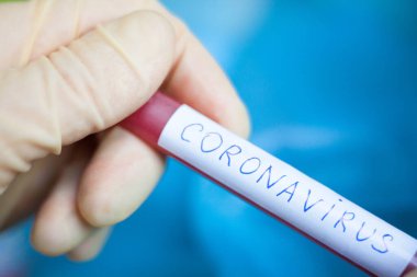 Coronavirus (Covid-19) enfeksiyonu için test tüpü tutan tıbbi eldivenleri teslim edin. Coronavirüs salgını.