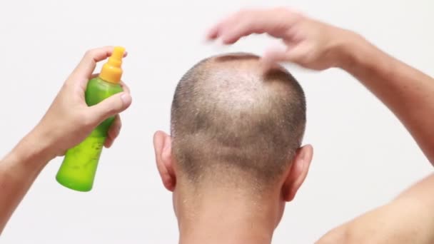 Back Shot Bald Man Using Hair Restorer — Stock Video
