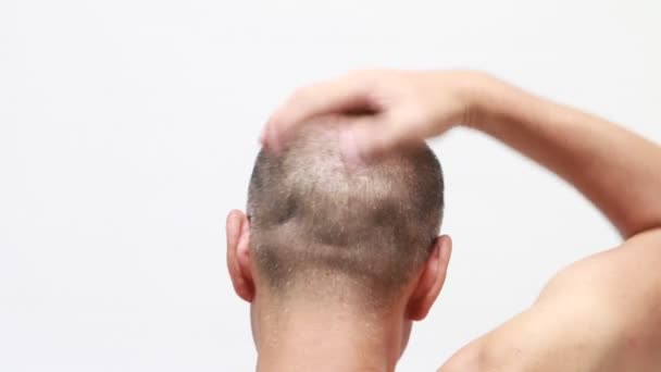 Volver Tiro Hombre Calvo Usando Restaurador Cabello — Vídeo de stock