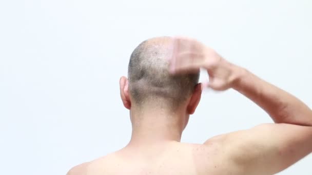 Назад Постріл Лисий Чоловік Використовує Відновлювач Волосся — стокове відео