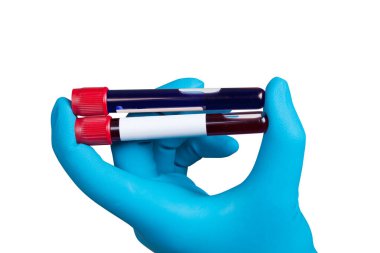 Corona virüsü salgını. Salgın Virüsü Solunum Sendromu.