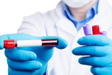 Corona virüsü salgını. Salgın Virüsü Solunum Sendromu.