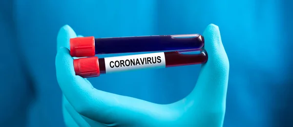 Brote Del Virus Corona Virus Epidémico Síndrome Respiratorio — Foto de Stock