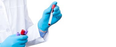 Corona virüsü salgını. Salgın Virüsü Solunum Sendromu.