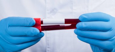 Corona virüsü salgını. Salgın Virüsü Solunum Sendromu.