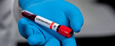 Corona virüsü salgını. Salgın Virüsü Solunum Sendromu.