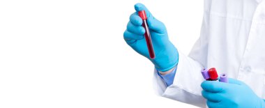 Corona virüsü salgını. Salgın Virüsü Solunum Sendromu.